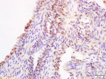 HOXA11 Rabbit Polyclonal Antibody