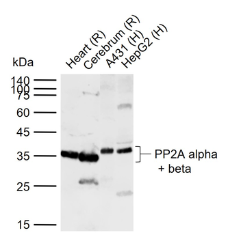 PP2A alpha + beta Rabbit Polyclonal Antibody
