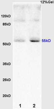 RBPJK Rabbit Polyclonal Antibody