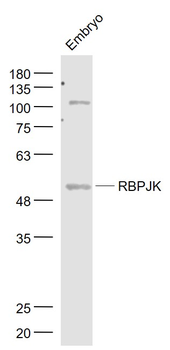 RBPJK Rabbit Polyclonal Antibody