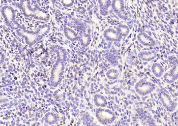 IFRD1 Rabbit Polyclonal Antibody