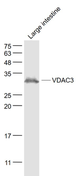 VDAC3 Rabbit Polyclonal Antibody