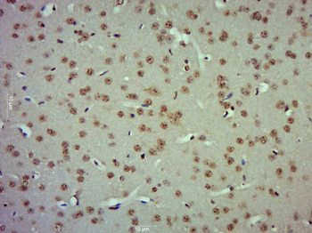 ZBTB2 Rabbit Polyclonal Antibody