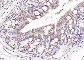 NAT10 Rabbit Polyclonal Antibody