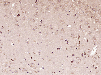 VPS4a Rabbit Polyclonal Antibody