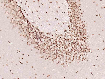 NIFK Rabbit Polyclonal Antibody