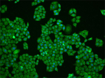 PAK1 Rabbit Polyclonal Antibody