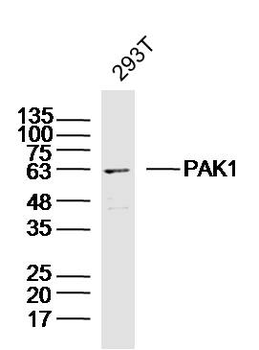 PAK1 Rabbit Polyclonal Antibody