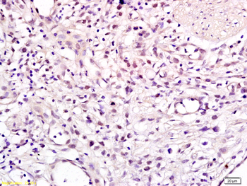 CHMP1A Rabbit Polyclonal Antibody