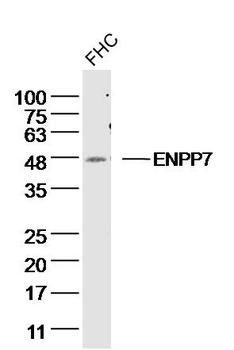 ENPP7 Rabbit Polyclonal Antibody