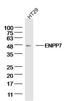 ENPP7 Rabbit Polyclonal Antibody