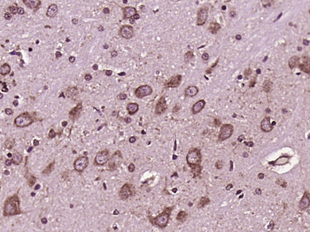 Axin 2 Rabbit Polyclonal Antibody