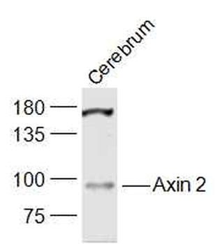Axin 2 Rabbit Polyclonal Antibody