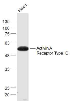 Activin A Receptor Type IC Rabbit Polyclonal Antibody