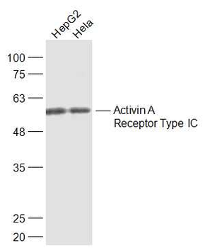 Activin A Receptor Type IC Rabbit Polyclonal Antibody