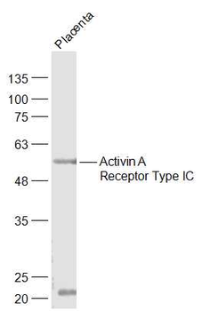 Activin A Receptor Type IC Rabbit Polyclonal Antibody