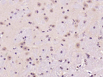Ferritin Heavy Chain/FTH1 Rabbit Polyclonal Antibody