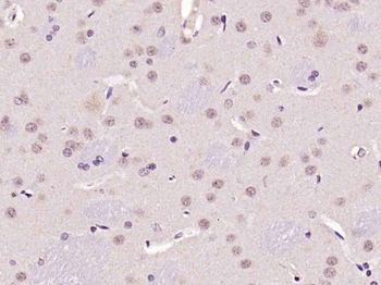 Ferritin Heavy Chain/FTH1 Rabbit Polyclonal Antibody
