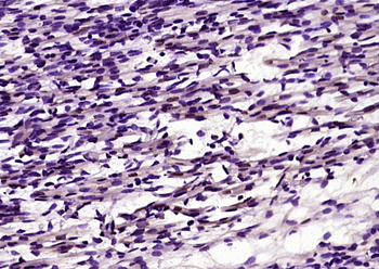 ANP32C Rabbit Polyclonal Antibody