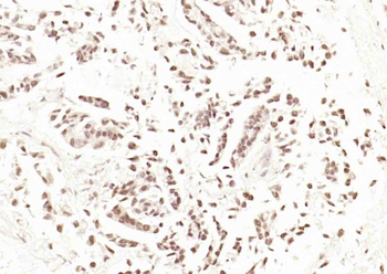 RSRC2 Rabbit Polyclonal Antibody