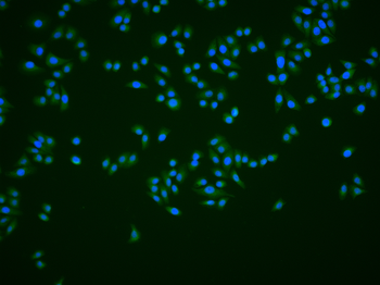 NET1 Rabbit Polyclonal Antibody
