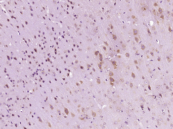 NET1 Rabbit Polyclonal Antibody