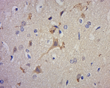 PRR11 Rabbit Polyclonal Antibody