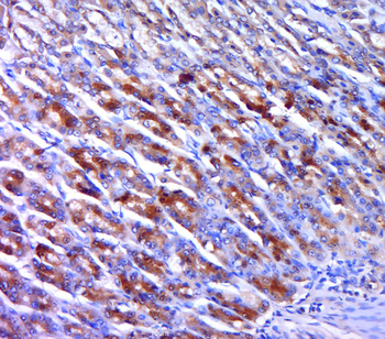 UEVLD Rabbit Polyclonal Antibody