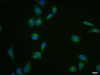 DICER1 Rabbit Polyclonal Antibody