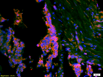 ATF3 Rabbit Polyclonal Antibody
