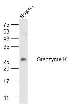 Granzyme K Rabbit Polyclonal Antibody