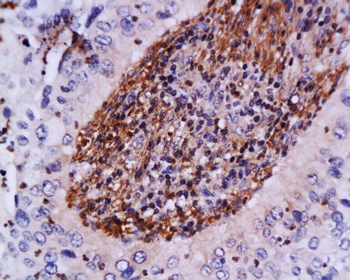 ATM Rabbit Polyclonal Antibody