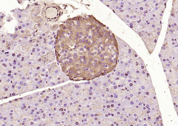 ATF6 Rabbit Polyclonal Antibody
