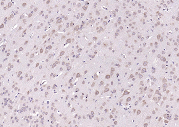 PIK3R1 Rabbit Polyclonal Antibody