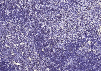 PIK3R1 Rabbit Polyclonal Antibody