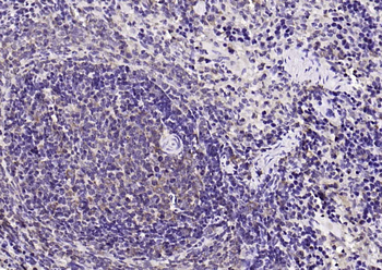 PIK3R1 Rabbit Polyclonal Antibody