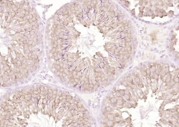 CLK3 Rabbit Polyclonal Antibody