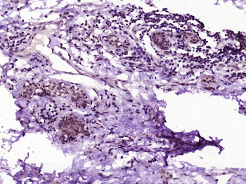 TBRG1 Rabbit Polyclonal Antibody