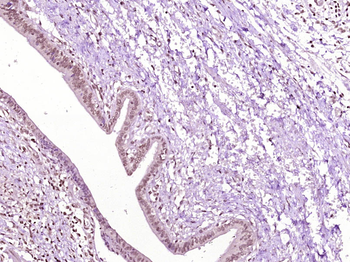 TBRG1 Rabbit Polyclonal Antibody