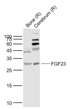 FGF23 Rabbit Polyclonal Antibody