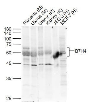 B7H4 Rabbit Polyclonal Antibody