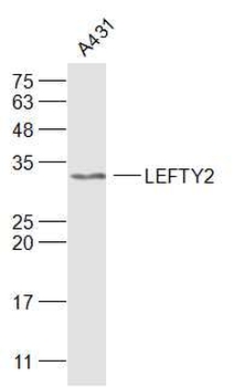 TGFB4/LEFTY2 Rabbit Polyclonal Antibody