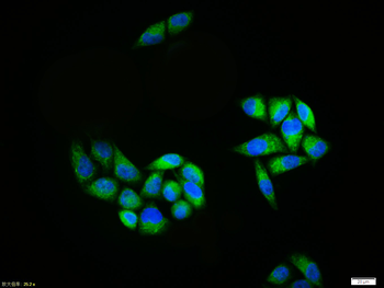 BACE1 Rabbit Polyclonal Antibody