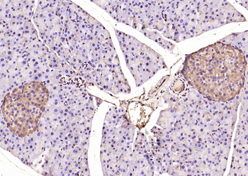 BACE1 Rabbit Polyclonal Antibody