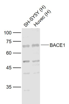 BACE1 Rabbit Polyclonal Antibody