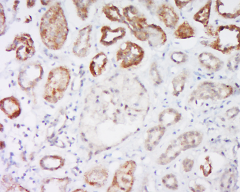 Bad Rabbit Polyclonal Antibody