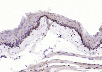 CRABP2 Rabbit Polyclonal Antibody