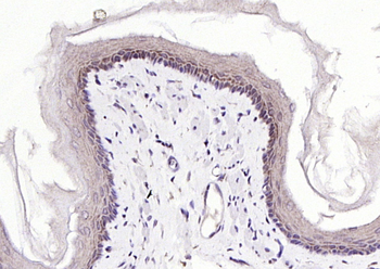 CRABP2 Rabbit Polyclonal Antibody