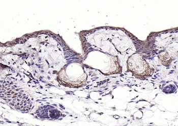 CRABP2 Rabbit Polyclonal Antibody