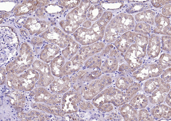 Bad Rabbit Polyclonal Antibody